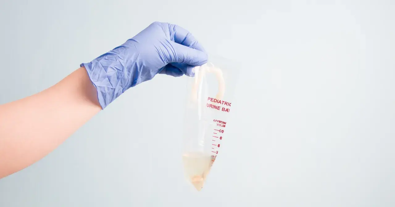 Ręka w niebieskiej rękawiczce trzyma woreczek na mocz dla dziewczynki. Woreczek jest przezroczysty, z podziałką i napisem "Pediatric Urine Bag".