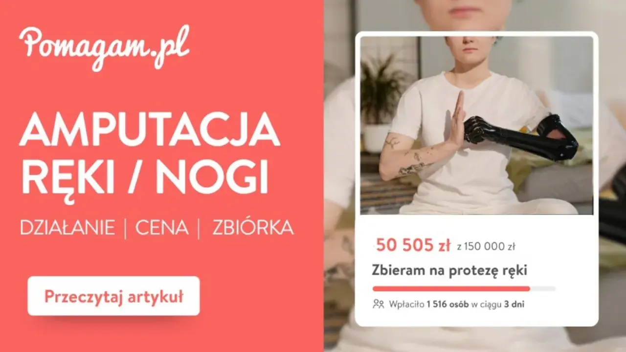 Rehabilitacja po amputacji kończyny dolnej NFZ. Zbiórka na protezę ręki, wsparcie dla osób po amputacji.