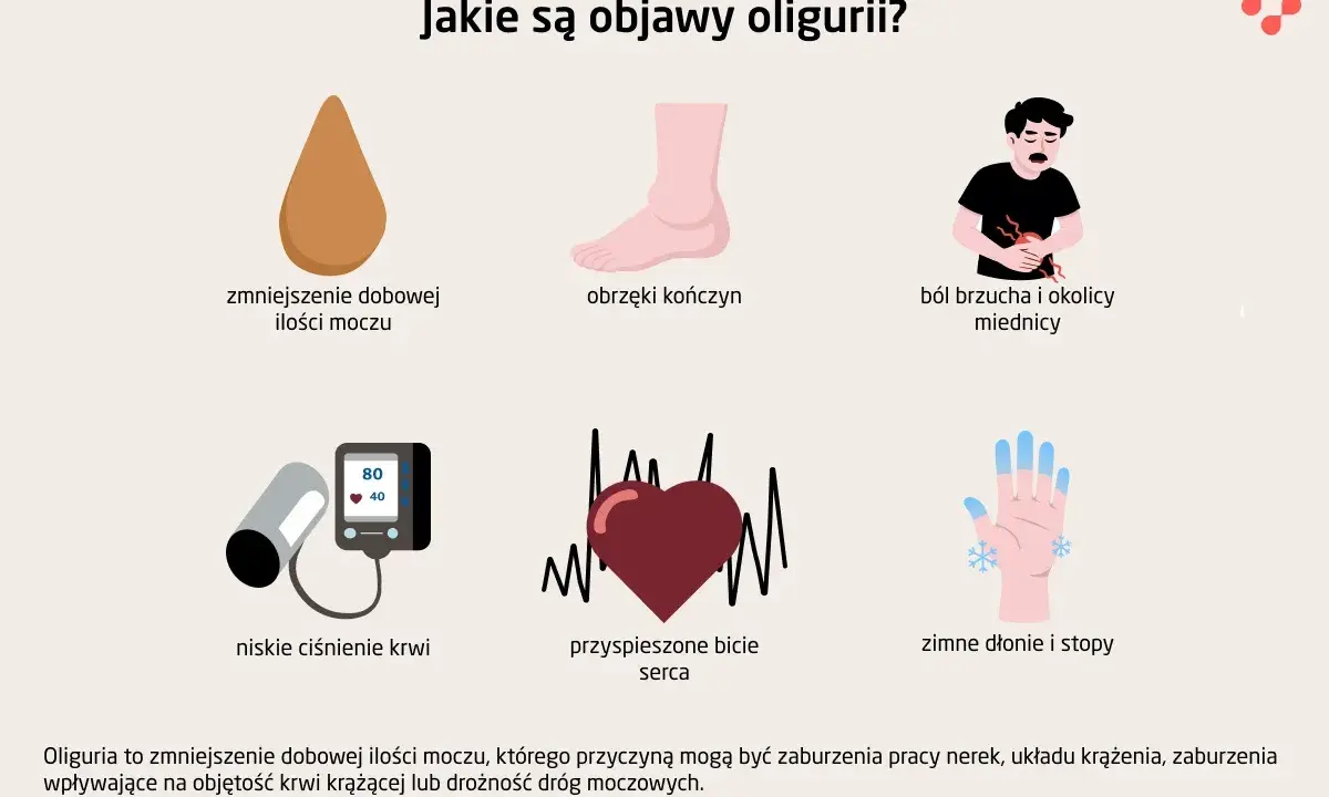Objawy oligurii: zmniejszenie dobowej ilości moczu, obrzęki, ból brzucha, niskie ciśnienie, przyspieszone bicie serca, zimne dłonie i stopy.