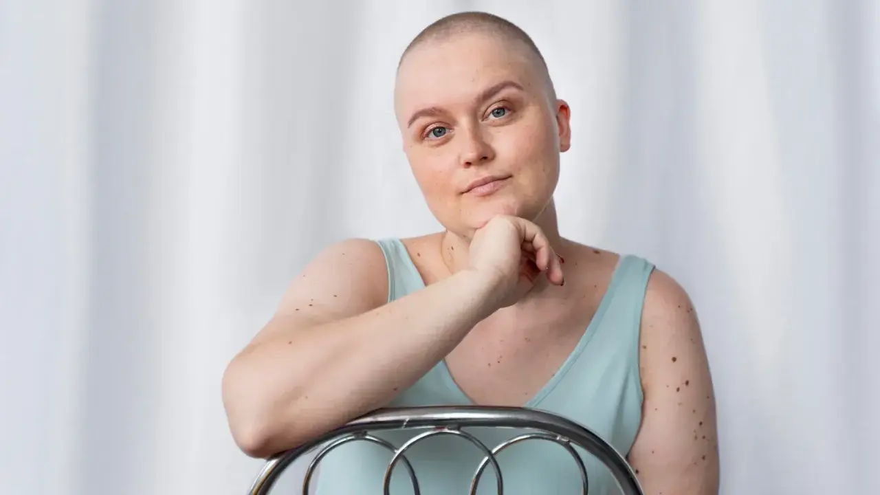 Kobieta po mastektomii, z łysą głową, opiera się o krzesło. Myśli o tym, jak uzyskać biustonosz po mastektomii refundacja.