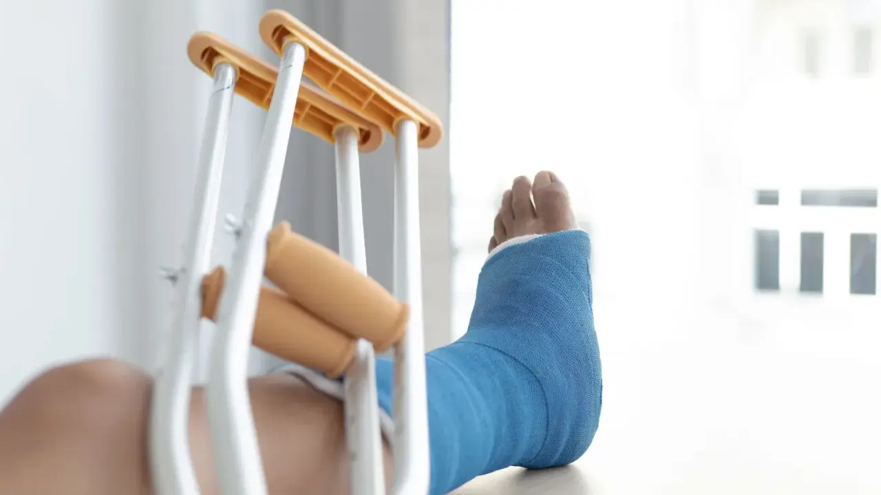 Noga w niebieskim gipsie, obok kul ortopedycznych. Diagnoza: złamanie kostki bocznej z przemieszczeniem.