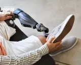 Osoba z protezą nogi przygotowuje się do wyjścia. Centrum Medyczne Sports Medic oferuje kompleksowe ośrodki rehabilitacyjne po amputacji kończyn.