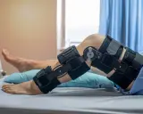 Pacjent w orteza kolana leży w łóżku. Orteza jest noszona bezpośrednio na skórze, a nie na spodniach.