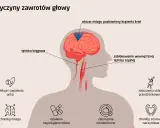 Przyczyny zawrotów głowy u osób starszych: blokada tętnicy, choroby mózgu, infekcje ucha, zaburzenia metaboliczne i sercowo-naczyniowe.