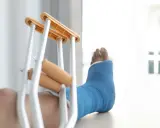 Noga w niebieskim gipsie, obok kul ortopedycznych. Diagnoza: złamanie kostki bocznej z przemieszczeniem.