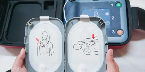 Instrukcja na elektrodach pokazuje, jak działa defibrylator: umieść elektrody na klatce piersiowej zgodnie z rysunkiem.