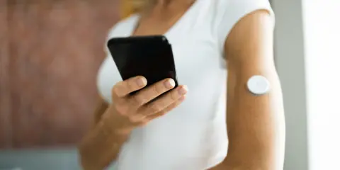 Kobieta z sensorem Freestyle Libre 2 na ramieniu sprawdza odczyty na telefonie. Dostępna refundacja ułatwia korzystanie z urządzenia.