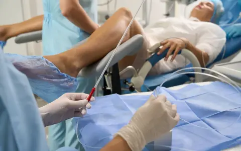 Personel medyczny przygotowuje cewnik. Pacjentka leży na fotelu ginekologicznym. Objawy zapchanego cewnika mogą być niepokojące.