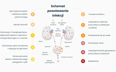 Schemat powstawania infekcji układu moczowego: od namnażania bakterii, przez kolonizację pęcherza, aż po uszkodzenie nerek i bakteriemię.
