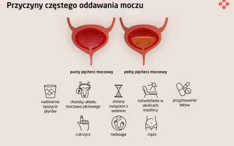 Ilustracja pokazuje przyczyny częstego oddawania moczu, w tym problemy z kręgosłupem lędźwiowym, które mogą wpływać na pęcherz.