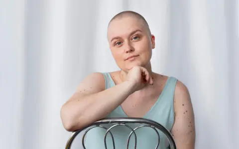 Kobieta po mastektomii, z łysą głową, opiera się o krzesło. Myśli o tym, jak uzyskać biustonosz po mastektomii refundacja.