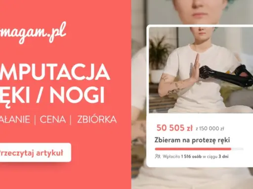 Rehabilitacja po amputacji kończyny dolnej NFZ. Zbiórka na protezę ręki, wsparcie dla osób po amputacji.