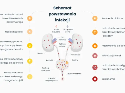 Schemat powstawania infekcji układu moczowego: od namnażania bakterii, przez kolonizację pęcherza, aż po uszkodzenie nerek i bakteriemię.