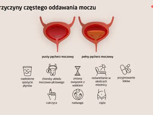 Ilustracja pokazuje przyczyny częstego oddawania moczu, w tym problemy z kręgosłupem lędźwiowym, które mogą wpływać na pęcherz.