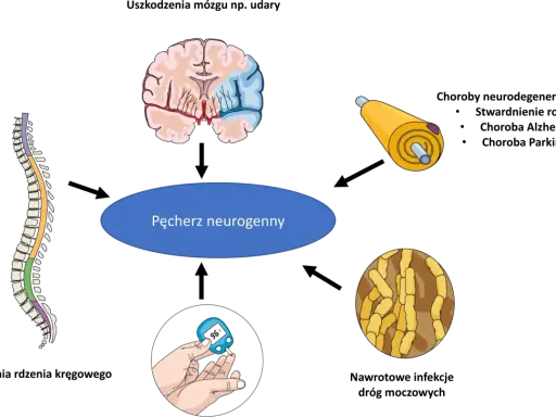 Ilustracja przedstawia mózg, rdzeń kręgowy, neuron i glukometr, sugerując, czy pęcherz neurogenny da się wyleczyć.