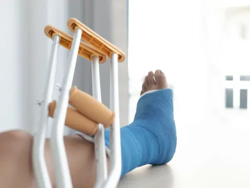 Noga w niebieskim gipsie, obok kul ortopedycznych. Diagnoza: złamanie kostki bocznej z przemieszczeniem.
