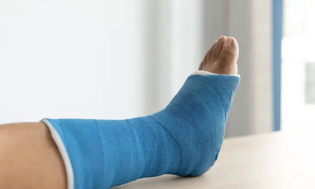 Niebieski gips na nodze po złamaniu trójkostkowym. Czekam na moment, kiedy będę mógł chodzić.