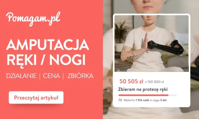 Rehabilitacja po amputacji kończyny dolnej NFZ. Zbiórka na protezę ręki, wsparcie dla osób po amputacji.