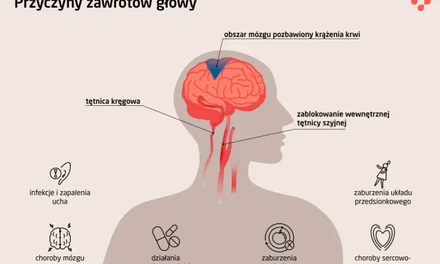 Przyczyny zawrotów głowy u osób starszych: blokada tętnicy, choroby mózgu, infekcje ucha, zaburzenia metaboliczne i sercowo-naczyniowe.