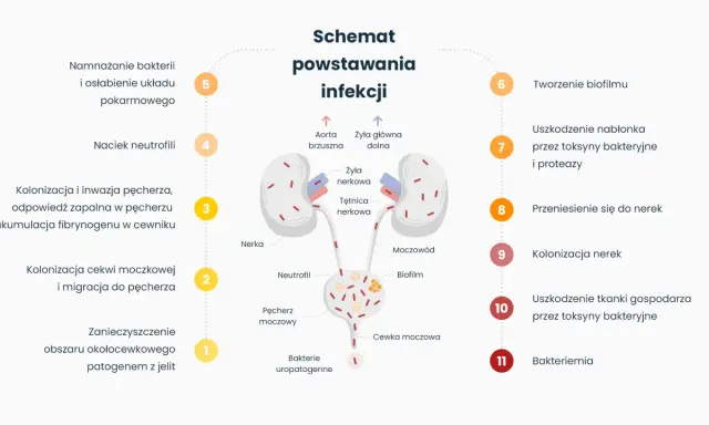 Schemat powstawania infekcji układu moczowego: od namnażania bakterii, przez kolonizację pęcherza, aż po uszkodzenie nerek i bakteriemię.