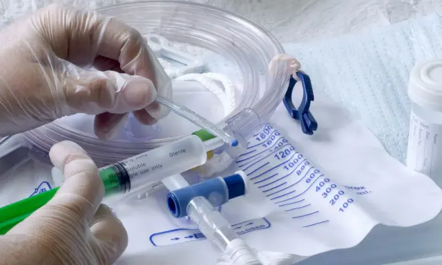 Rękawiczka medyczna przygotowuje żel lubrykujący do cewnikowania. Czy zakładanie cewnika boli? Zależy od wielu czynników, ale odpowiednie przygotowanie minimalizuje dyskomfort.