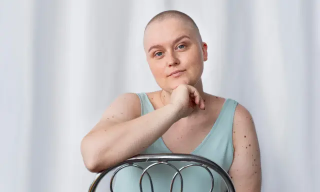 Kobieta po mastektomii, z łysą głową, opiera się o krzesło. Myśli o tym, jak uzyskać biustonosz po mastektomii refundacja.