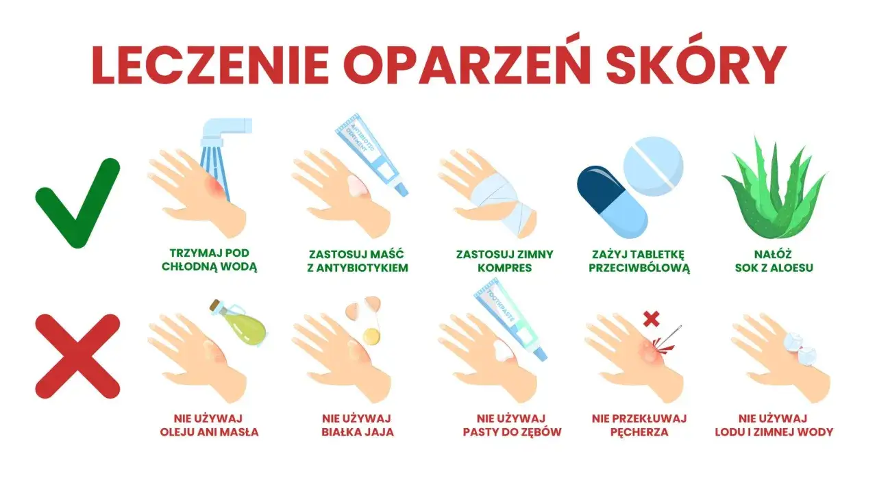 Pierwsza pomoc przy oparzeniach: chłodna woda, maść z antybiotykiem, zimny kompres, leki przeciwb&oacute;lowe, aloes. Unikaj masła, jajka, pasty do zęb&oacute;w, lodu.