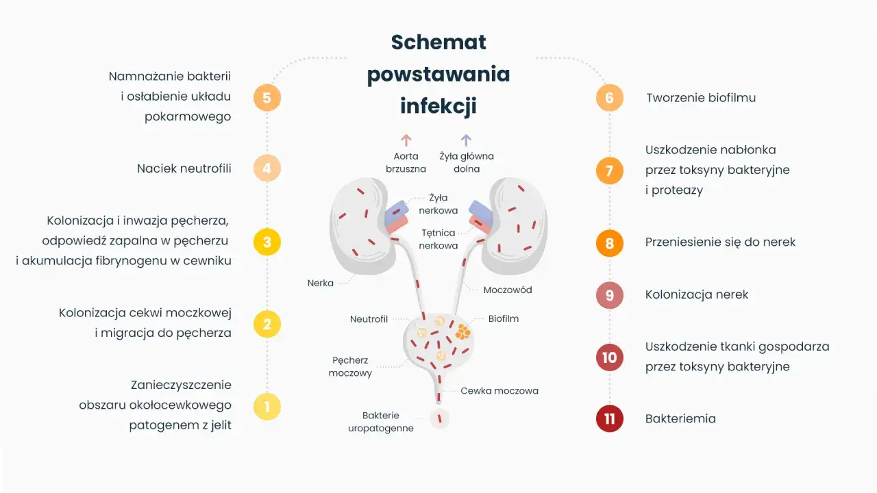 Schemat powstawania infekcji dróg moczowych, od zanieczyszczenia do bakteriemii. Objawy zapalenia dróg moczowych mogą być różne.