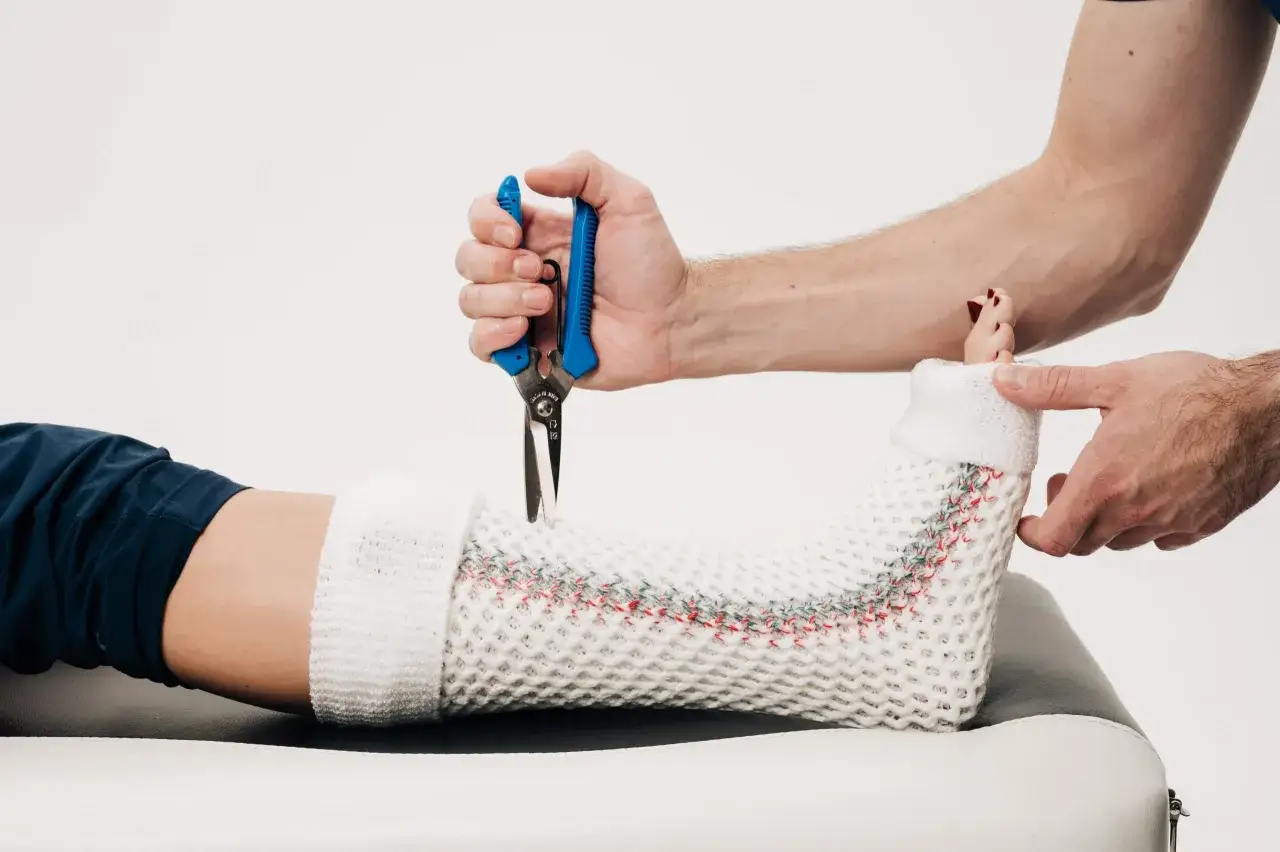 Lekarz zdejmuje gips, przygotowując pacjenta do zmiany na ortezę. Pytanie brzmi: po jakim czasie można zmienić gips na ortezę?