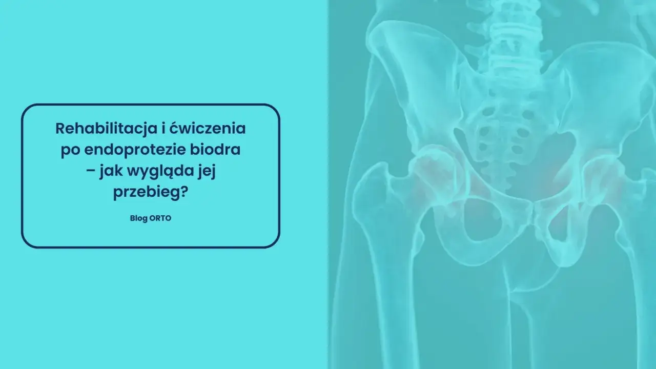 Rehabilitacja poszpitalna po endoprotezie biodra NFZ: ćwiczenia i przebieg. Widok miednicy i stawów biodrowych.