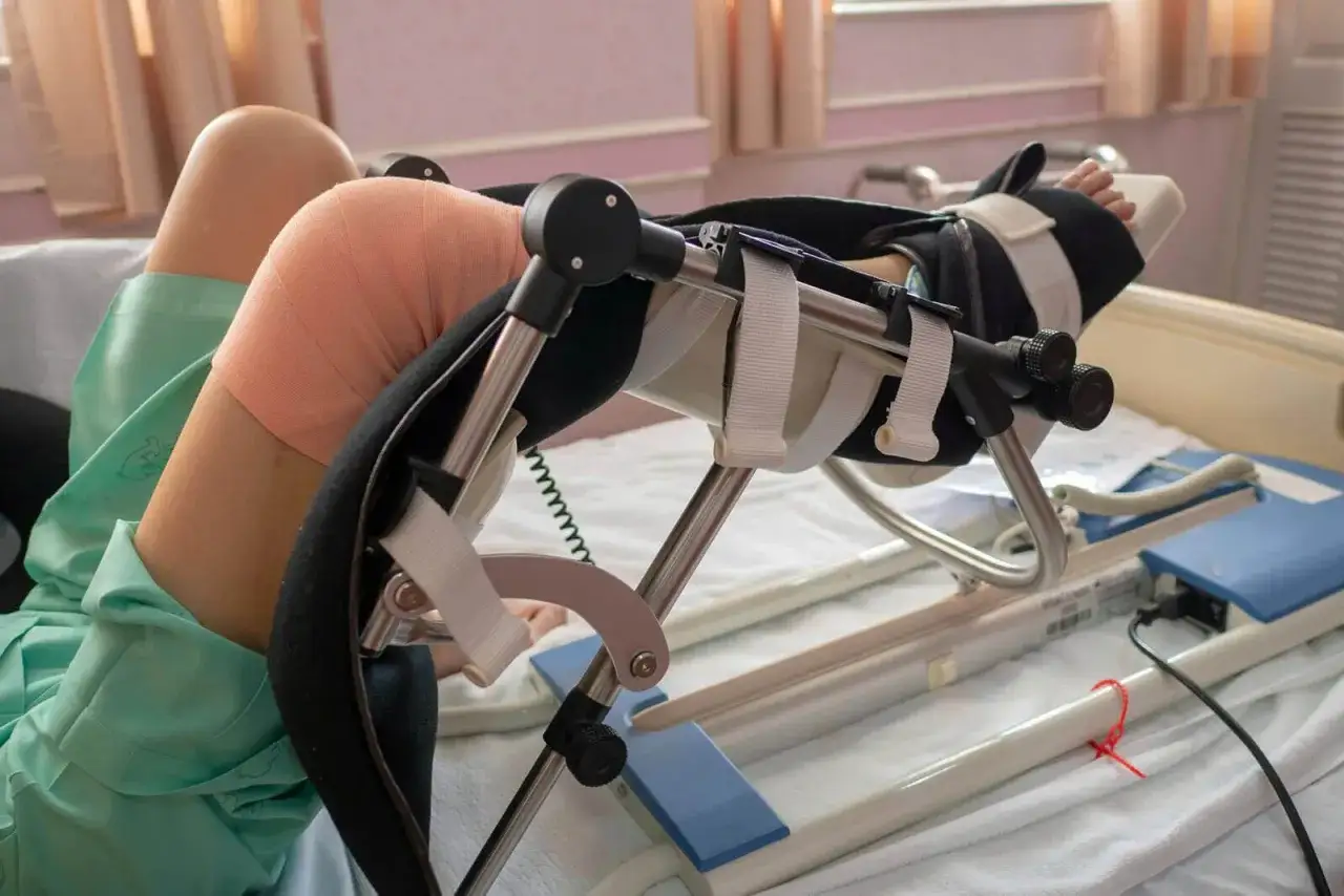 Osoba w szpitalnym łóżku z opatrzonym kolanem, korzystająca z szyny CPM do rehabilitacji.