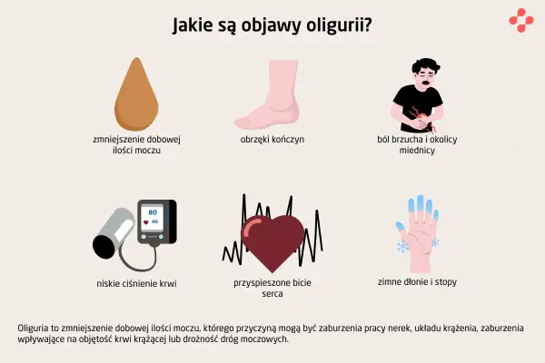 Objawy oligurii: zmniejszenie dobowej ilości moczu, obrzęki, ból brzucha, niskie ciśnienie, przyspieszone bicie serca, zimne dłonie i stopy.